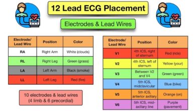 leads ecg placement
